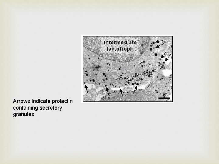 Arrows indicate prolactin containing secretory granules 