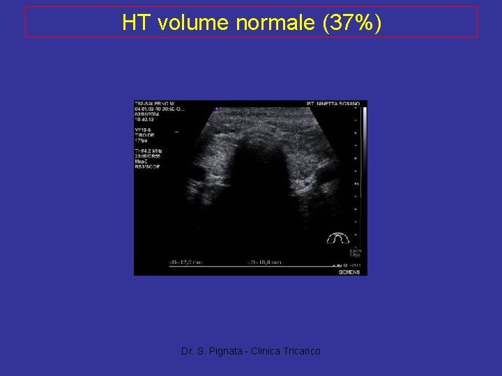 HT volume normale (37%) Dr. S. Pignata - Clinica Tricarico 