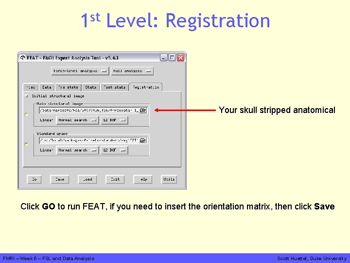 1 st Level: Registration Your skull stripped anatomical Click GO to run FEAT, if