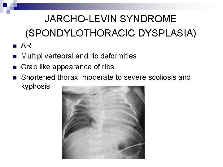 JARCHO-LEVIN SYNDROME (SPONDYLOTHORACIC DYSPLASIA) n n AR Multipl vertebral and rib deformities Crab like