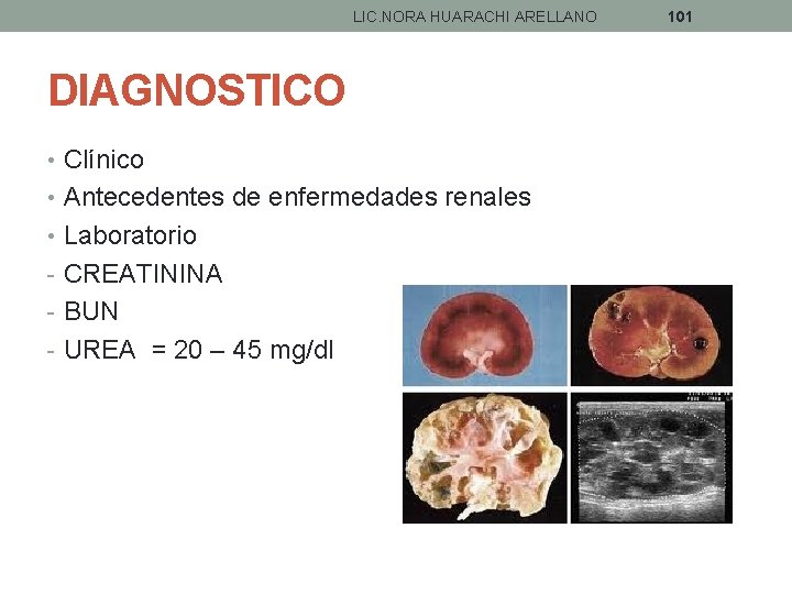 LIC. NORA HUARACHI ARELLANO DIAGNOSTICO • Clínico • Antecedentes de enfermedades renales • Laboratorio