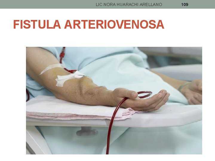 LIC. NORA HUARACHI ARELLANO FISTULA ARTERIOVENOSA 109 