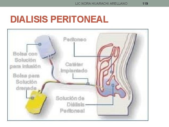 LIC. NORA HUARACHI ARELLANO DIALISIS PERITONEAL 119 