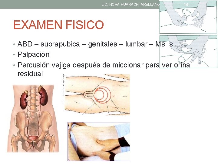 LIC. NORA HUARACHI ARELLANO 14 EXAMEN FISICO • ABD – suprapubica – genitales –