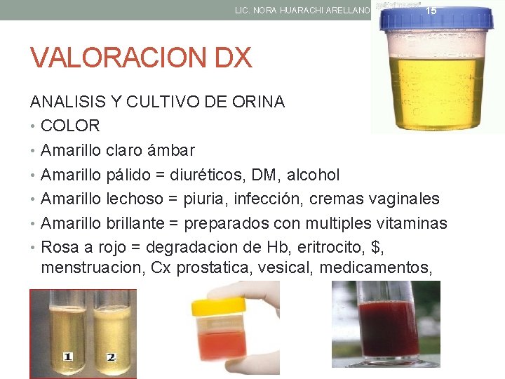 LIC. NORA HUARACHI ARELLANO 15 VALORACION DX ANALISIS Y CULTIVO DE ORINA • COLOR