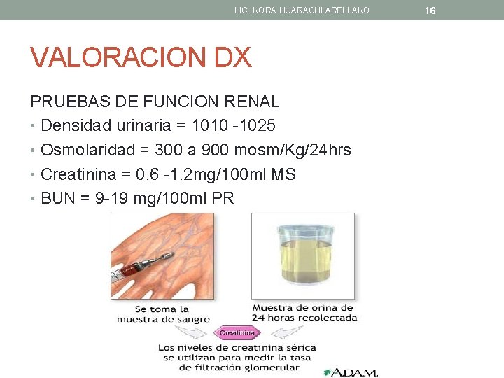 LIC. NORA HUARACHI ARELLANO VALORACION DX PRUEBAS DE FUNCION RENAL • Densidad urinaria =