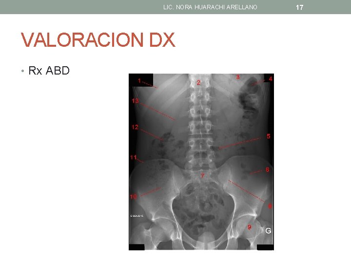 LIC. NORA HUARACHI ARELLANO VALORACION DX • Rx ABD 17 