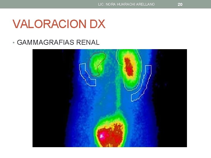 LIC. NORA HUARACHI ARELLANO VALORACION DX • GAMMAGRAFIAS RENAL 20 