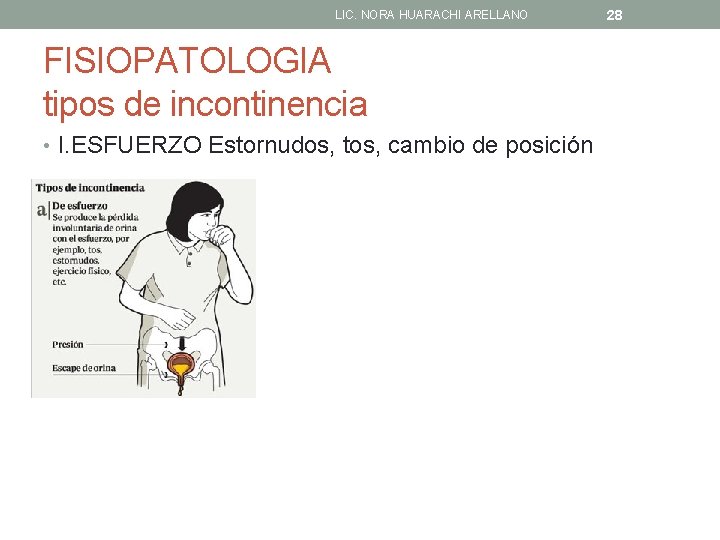 LIC. NORA HUARACHI ARELLANO FISIOPATOLOGIA tipos de incontinencia • I. ESFUERZO Estornudos, tos, cambio