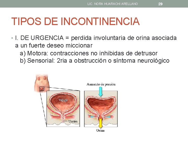 LIC. NORA HUARACHI ARELLANO 29 TIPOS DE INCONTINENCIA • I. DE URGENCIA = perdida