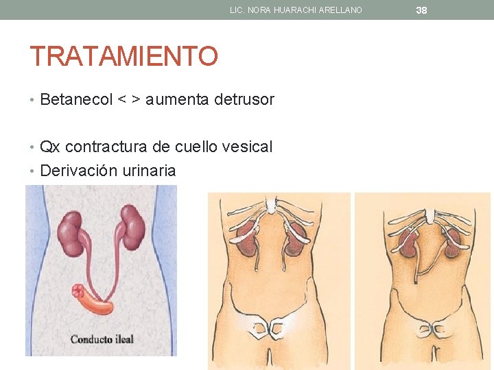 LIC. NORA HUARACHI ARELLANO TRATAMIENTO • Betanecol < > aumenta detrusor • Qx contractura