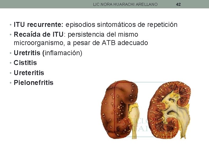 LIC. NORA HUARACHI ARELLANO 42 • ITU recurrente: episodios sintomáticos de repetición • Recaída