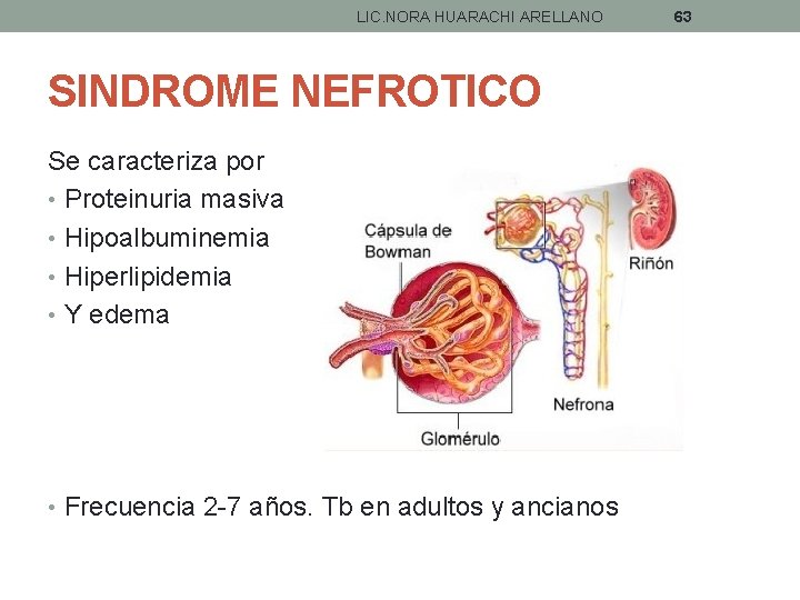 LIC. NORA HUARACHI ARELLANO SINDROME NEFROTICO Se caracteriza por • Proteinuria masiva • Hipoalbuminemia