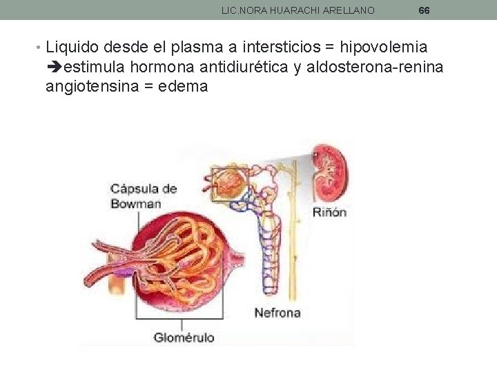 LIC. NORA HUARACHI ARELLANO 66 • Liquido desde el plasma a intersticios = hipovolemia