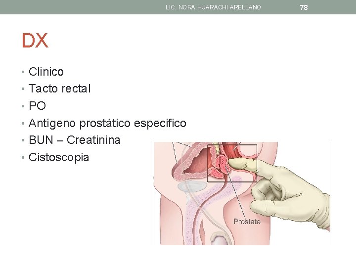 LIC. NORA HUARACHI ARELLANO DX • Clinico • Tacto rectal • PO • Antígeno