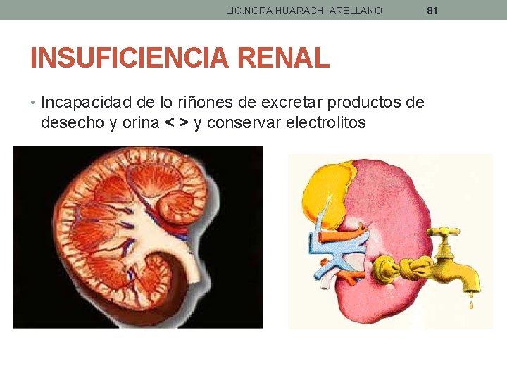 LIC. NORA HUARACHI ARELLANO INSUFICIENCIA RENAL • Incapacidad de lo riñones de excretar productos