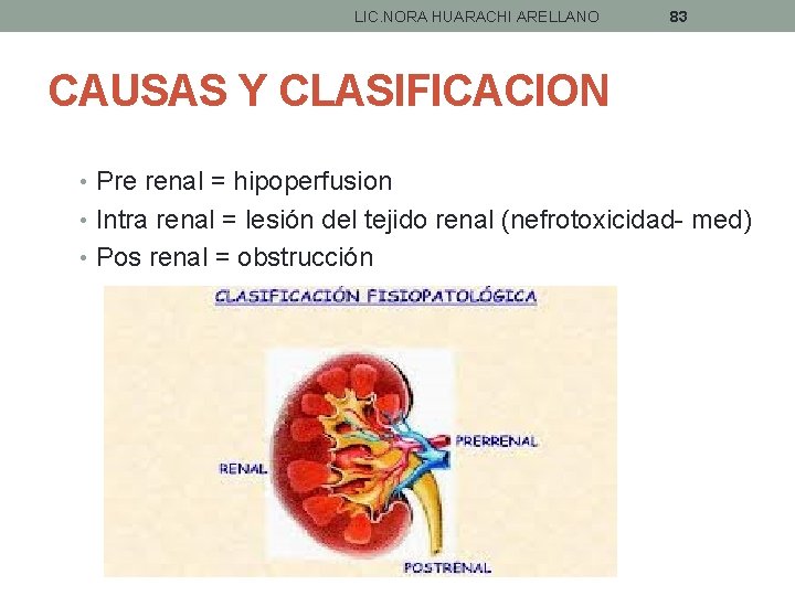 LIC. NORA HUARACHI ARELLANO 83 CAUSAS Y CLASIFICACION • Pre renal = hipoperfusion •