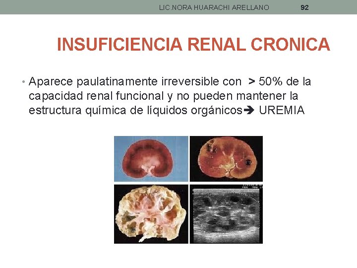 LIC. NORA HUARACHI ARELLANO 92 INSUFICIENCIA RENAL CRONICA • Aparece paulatinamente irreversible con >