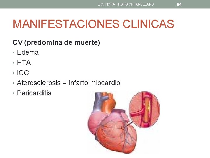 LIC. NORA HUARACHI ARELLANO MANIFESTACIONES CLINICAS CV (predomina de muerte) • Edema • HTA