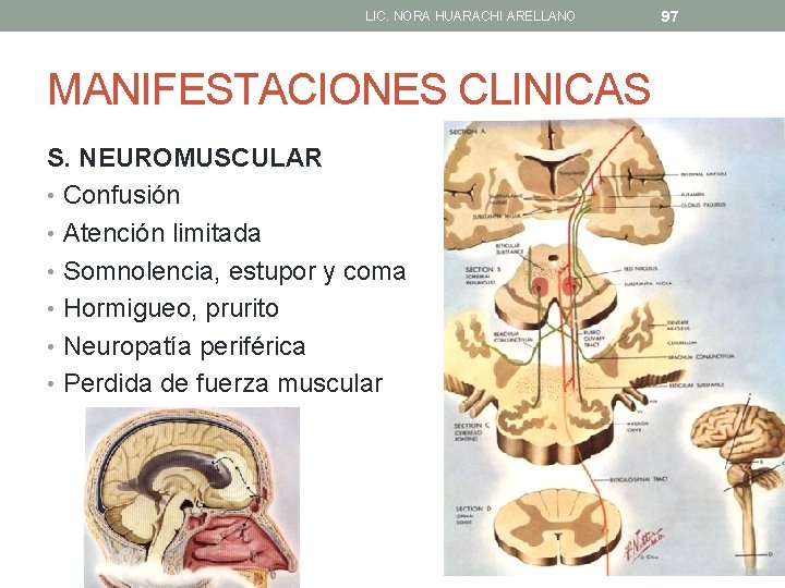 LIC. NORA HUARACHI ARELLANO MANIFESTACIONES CLINICAS S. NEUROMUSCULAR • Confusión • Atención limitada •