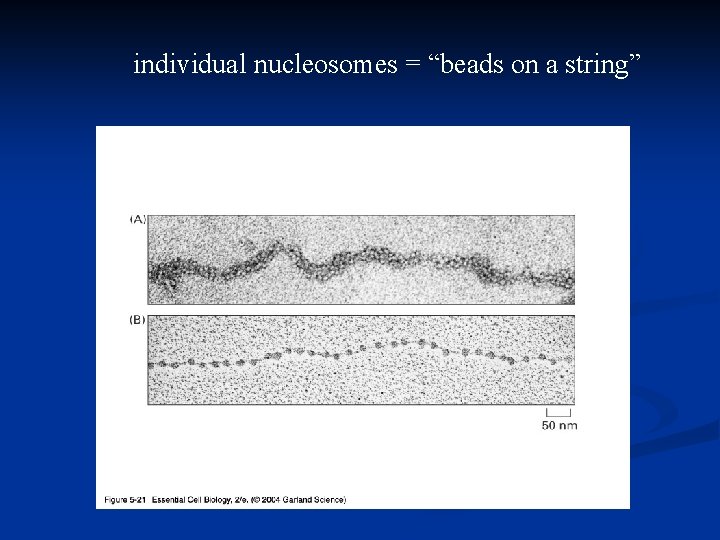 individual nucleosomes = “beads on a string” 