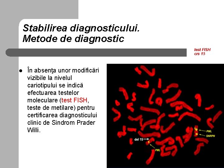 Stabilirea diagnosticului. Metode de diagnostic test FISH crs 15 l În absenţa unor modificări