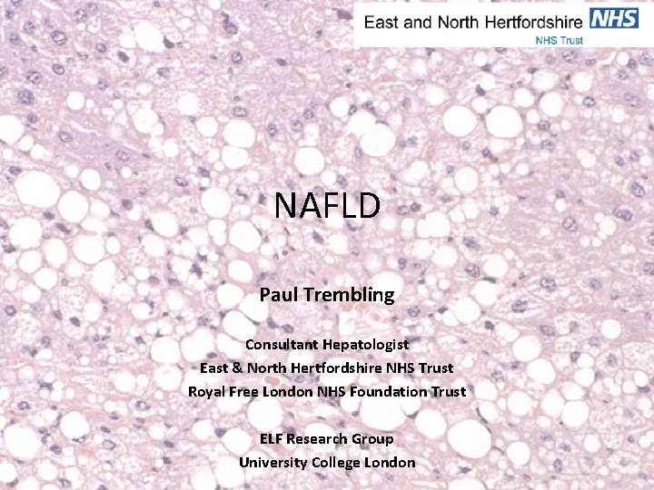 NAFLD Paul Trembling Consultant Hepatologist East & North Hertfordshire NHS Trust Royal Free London