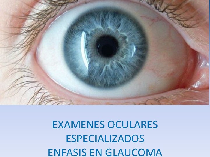 EXAMENES OCULARES ESPECIALIZADOS ENFASIS EN GLAUCOMA 