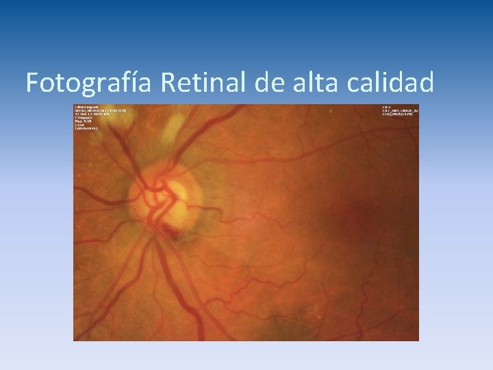 Fotografía Retinal de alta calidad 