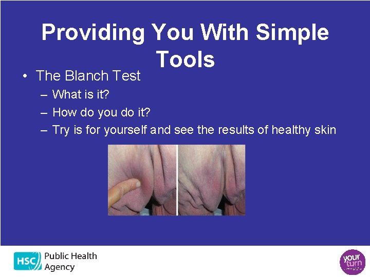 Providing You With Simple Tools • The Blanch Test – What is it? –