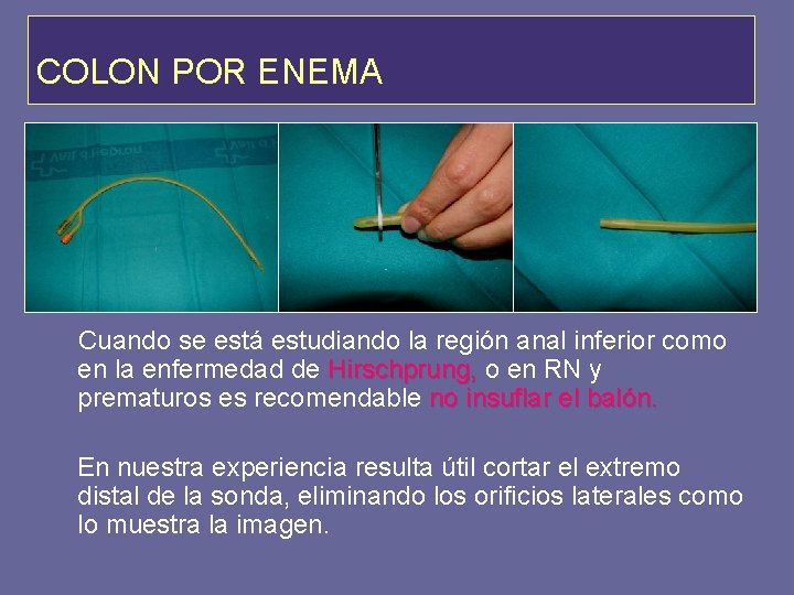 COLON POR ENEMA Cuando se está estudiando la región anal inferior como en la