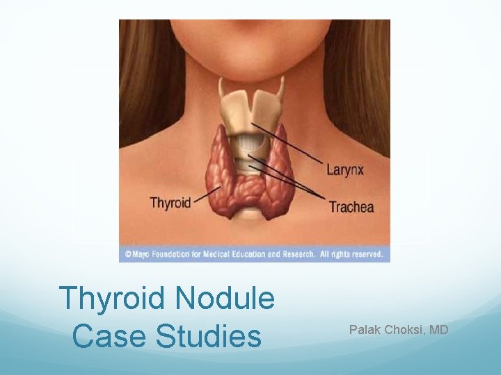 Thyroid Nodule Case Studies Palak Choksi, MD 