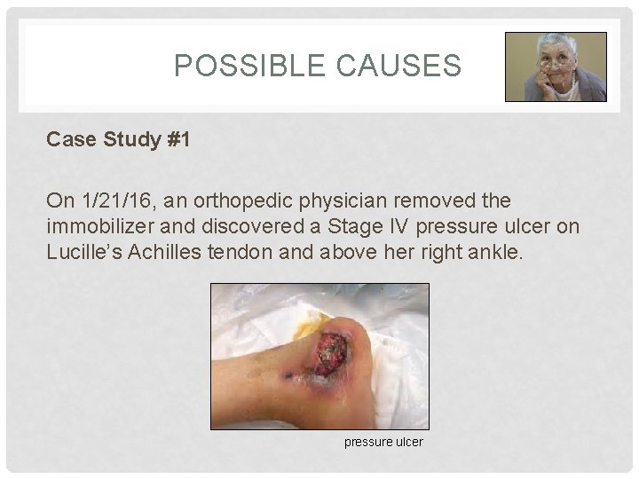 POSSIBLE CAUSES Case Study #1 On 1/21/16, an orthopedic physician removed the immobilizer and