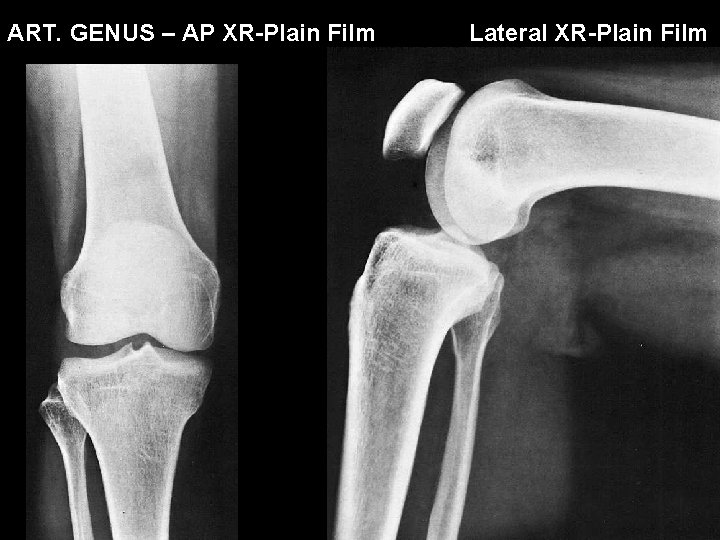 ART. GENUS – AP XR-Plain Film Lateral XR-Plain Film 