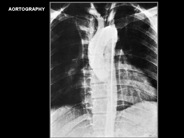 AORTOGRAPHY 