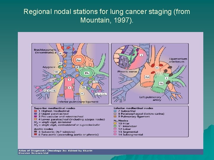 Regional nodal stations for lung cancer staging (from Mountain, 1997). 