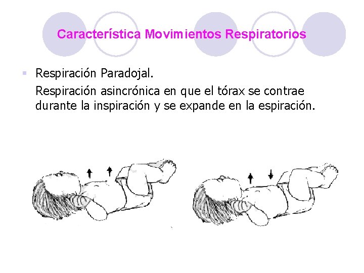 Característica Movimientos Respiratorios § Respiración Paradojal. Respiración asincrónica en que el tórax se contrae Característica Movimientos Respiratorios § Respiración Paradojal. Respiración asincrónica en que el tórax se contrae