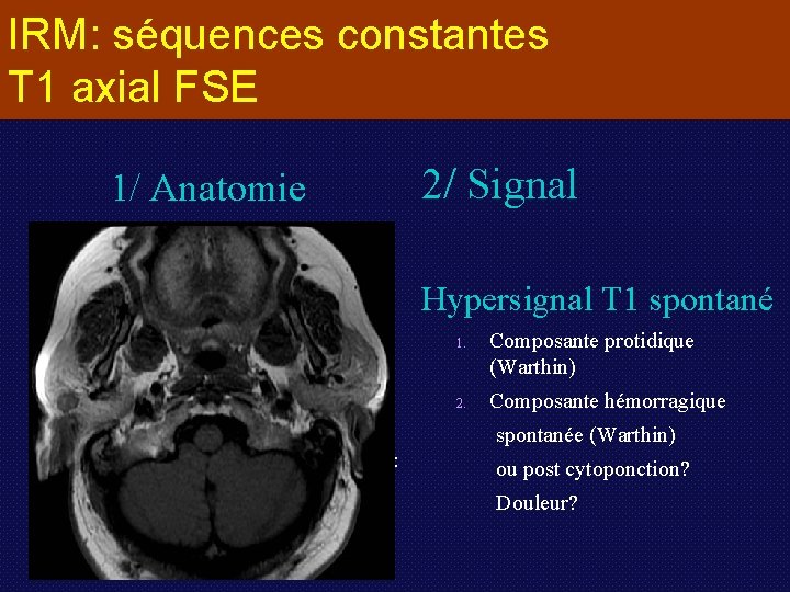 IRM: séquences constantes T 1 axial FSE 1/ Anatomie Profonde ou superficielle Par rapport