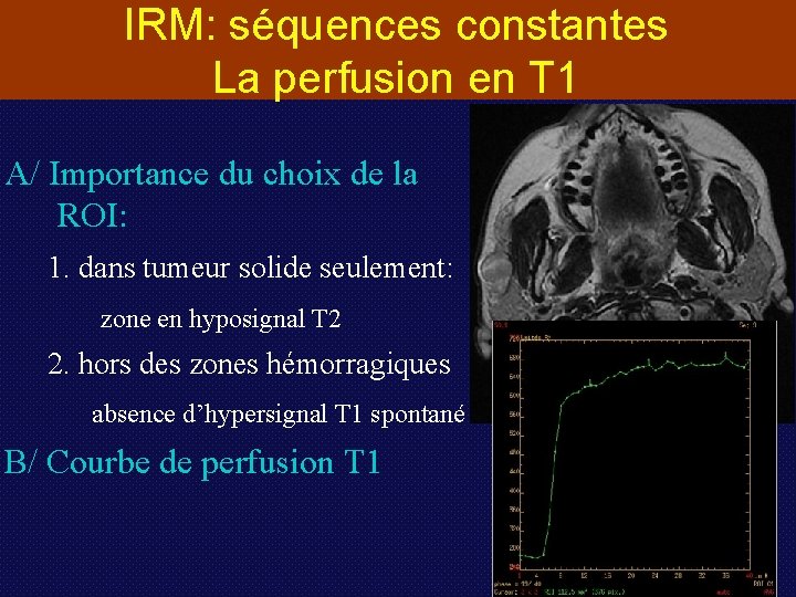 IRM: séquences constantes La perfusion en T 1 A/ Importance du choix de la