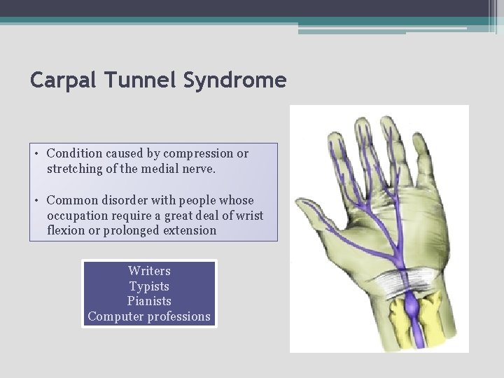 Carpal Tunnel Syndrome • Condition caused by compression or stretching of the medial nerve.