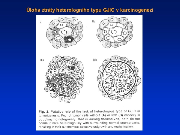 Úloha ztráty heterologního typu GJIC v karcinogenezi 