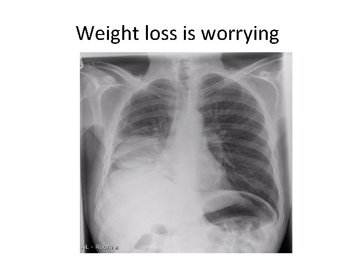 Weight loss is worrying Weight loss is worrying