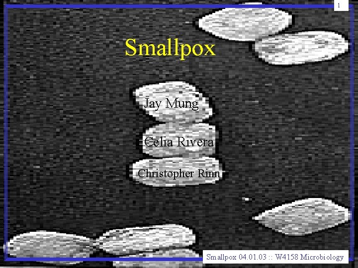 1 Smallpox Jay Mung Celia Rivera Christopher Rinn Smallpox 04. 01. 03 : : 1 Smallpox Jay Mung Celia Rivera Christopher Rinn Smallpox 04. 01. 03 : :