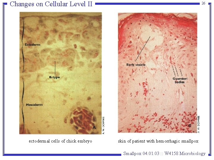 Changes on Cellular Level II ectodermal cells of chick embryo 26 skin of patient Changes on Cellular Level II ectodermal cells of chick embryo 26 skin of patient