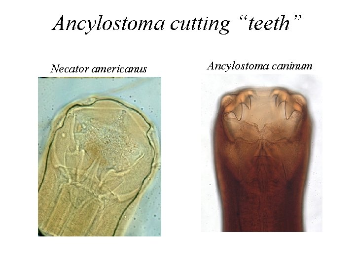 Ancylostoma cutting “teeth” Necator americanus Ancylostoma caninum Ancylostoma cutting “teeth” Necator americanus Ancylostoma caninum