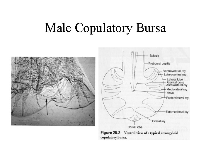 Male Copulatory Bursa Male Copulatory Bursa