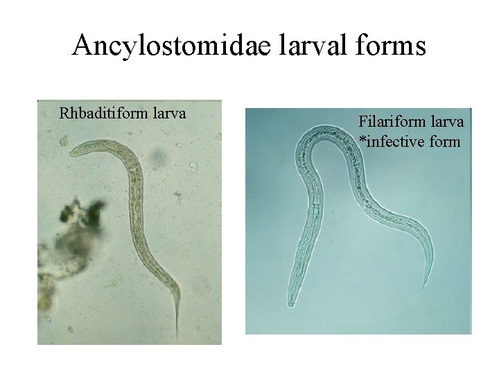 Ancylostomidae larval forms Rhbaditiform larva Filariform larva *infective form Ancylostomidae larval forms Rhbaditiform larva Filariform larva *infective form