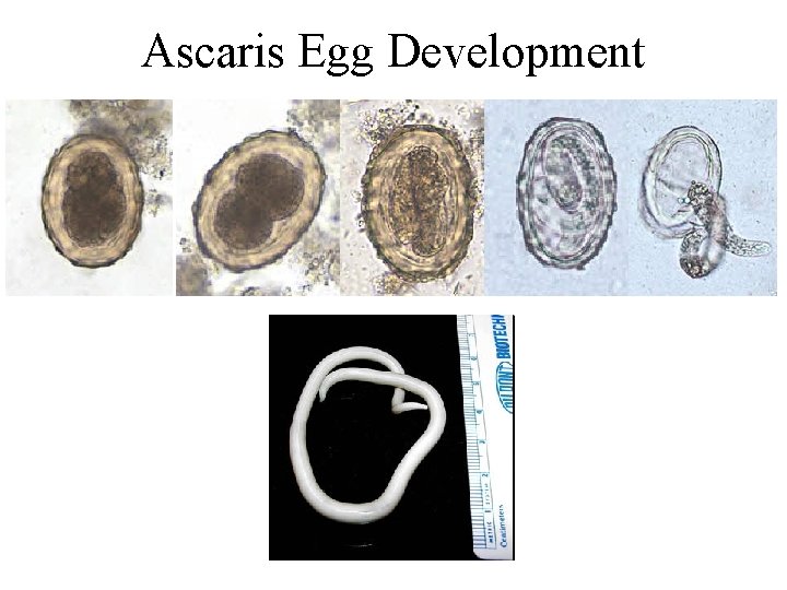 Ascaris Egg Development Ascaris Egg Development