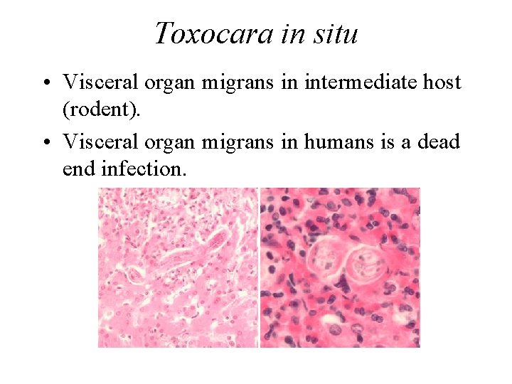Toxocara in situ • Visceral organ migrans in intermediate host (rodent). • Visceral organ Toxocara in situ • Visceral organ migrans in intermediate host (rodent). • Visceral organ