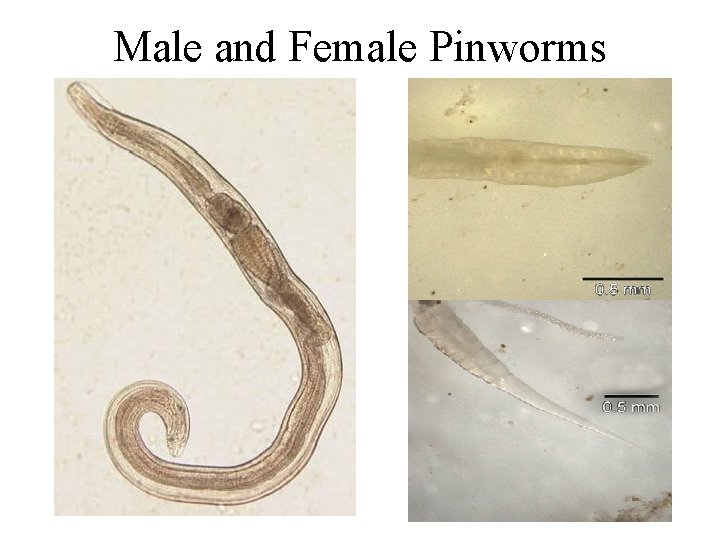 Male and Female Pinworms Male and Female Pinworms